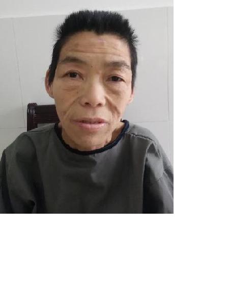 流浪人员无名氏01（龚田镇）照片，让爱回家