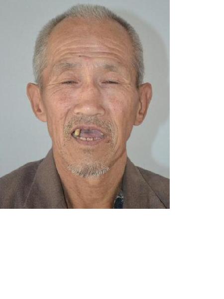流浪人员毛喜平照片，让爱回家
