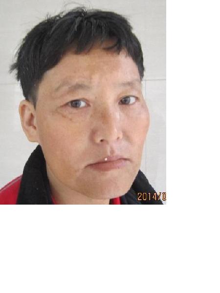 流浪人员无名女86号照片，让爱回家