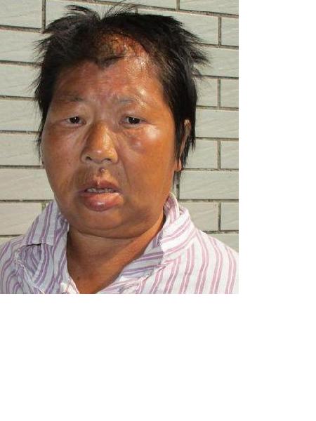 流浪人员女无名氏1照片，让爱回家