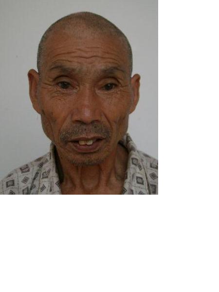 流浪人员无名氏驼背照片，让爱回家