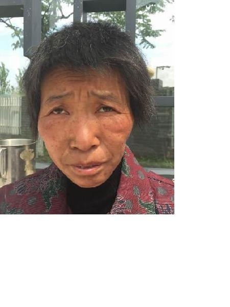 流浪人员邢燕（自述）照片，让爱回家