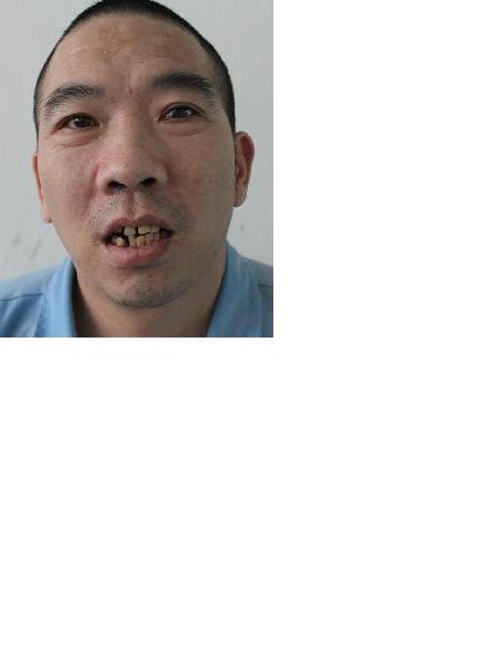 流浪人员无名氏150274照片，让爱回家