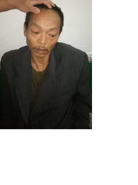 流浪人员无名氏（医疗救助328）照片，让爱回家