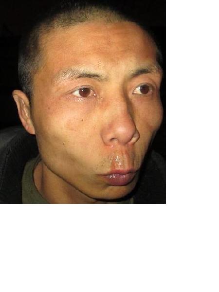 流浪人员刘献恩照片，让爱回家