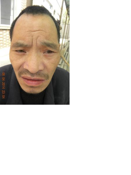 流浪人员无名氏照片，让爱回家