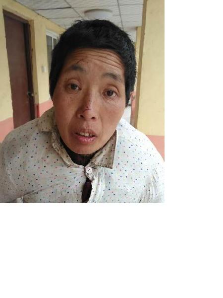 流浪人员无名女照片，让爱回家