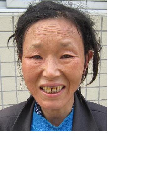 流浪人员无名女108号照片，让爱回家