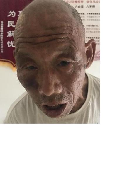 流浪人员罗救111照片，让爱回家