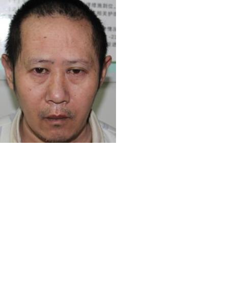 流浪人员张光强照片，让爱回家