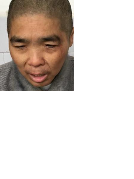 流浪人员无名氏照片，让爱回家
