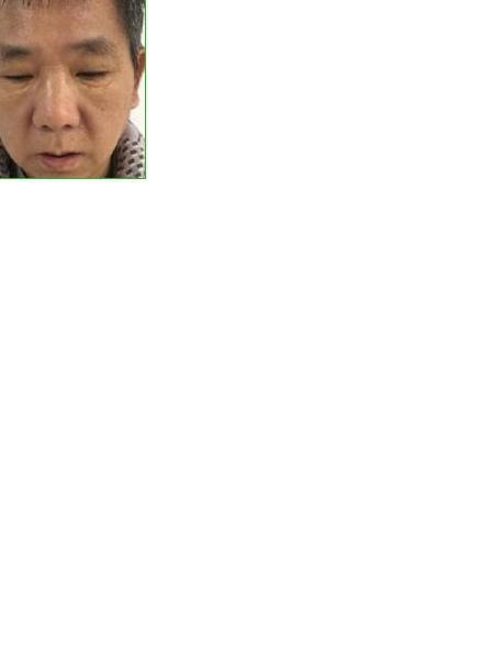 流浪人员袁正宏照片，让爱回家