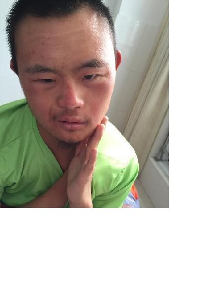 流浪人员杨青照片，让爱回家