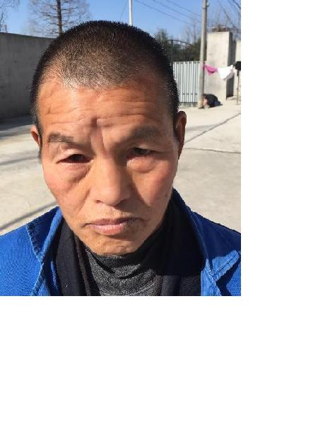 流浪人员未知名照片，让爱回家