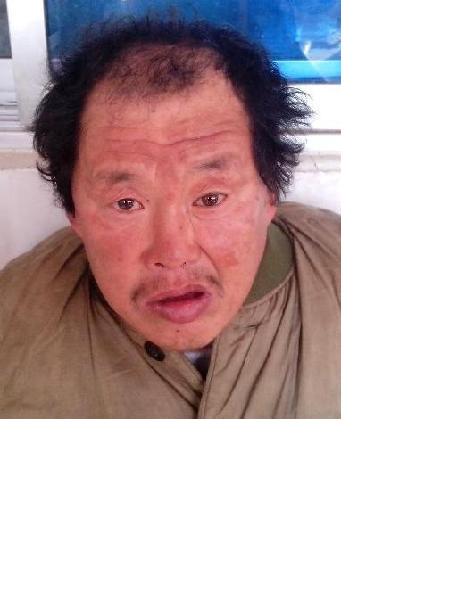 流浪人员熊二照片，让爱回家