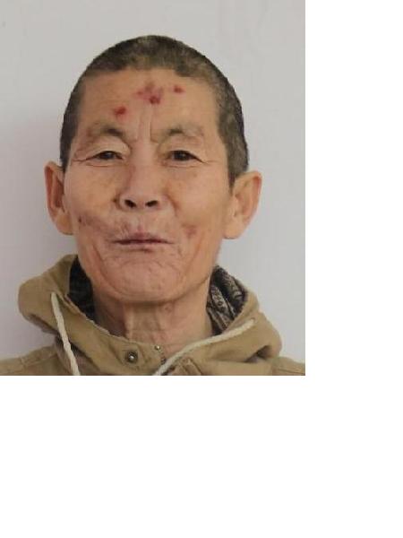 流浪人员无名氏（龙44）照片，让爱回家