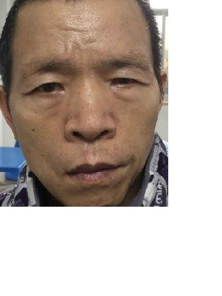 流浪人员049莫国华男(康复医院)照片，让爱回家