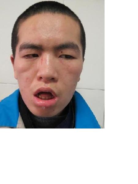流浪人员救助138号照片，让爱回家