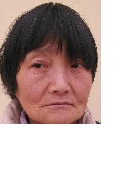 流浪人员无名女3照片，让爱回家