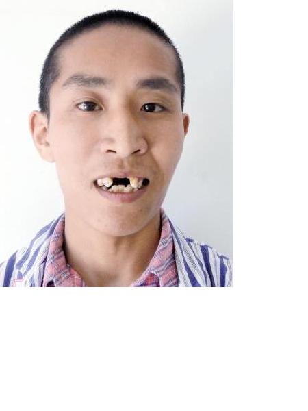 流浪人员孙向龙照片，让爱回家
