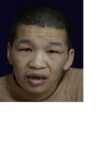 流浪人员衡救A252照片，让爱回家