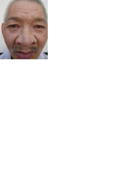 流浪人员无名氏照片，让爱回家