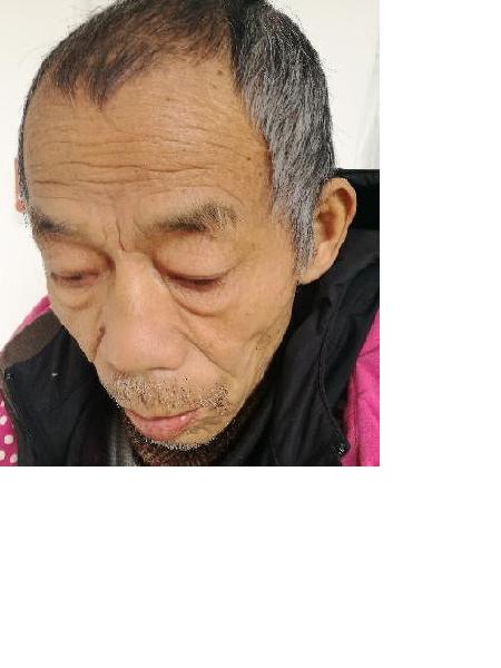 流浪人员2016无名（7）照片，让爱回家