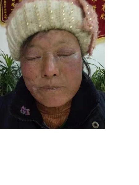 流浪人员无名氏（自称杨静玲）照片，让爱回家