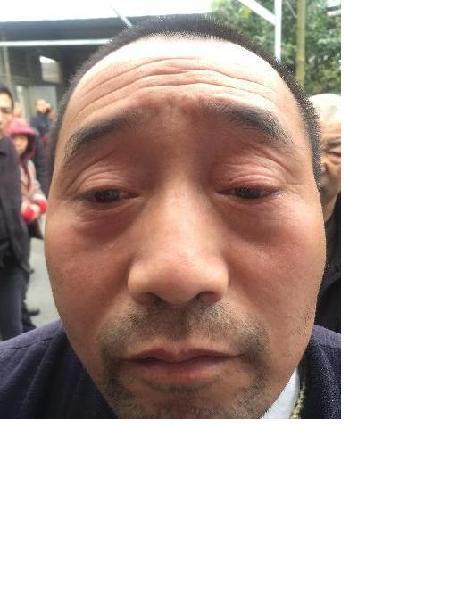 流浪人员苟天平照片，让爱回家