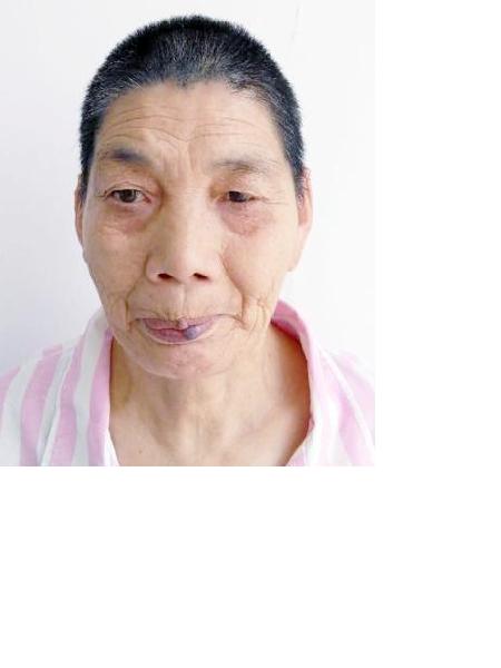 流浪人员余淑玲照片，让爱回家