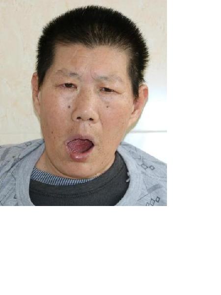 流浪人员滕爱艳照片，让爱回家