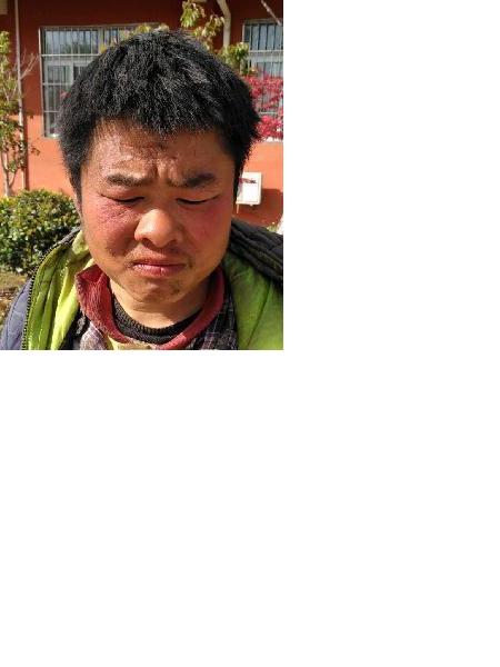 流浪人员无名男照片，让爱回家