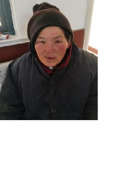 流浪人员无名女照片，让爱回家