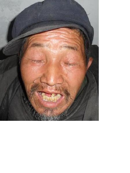 流浪人员无名照片，让爱回家