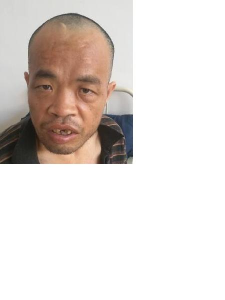 流浪人员无名氏（宁广02）照片，让爱回家