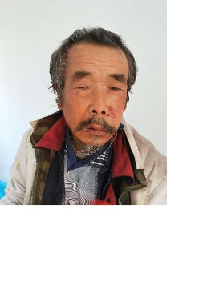 流浪人员侯救018照片，让爱回家
