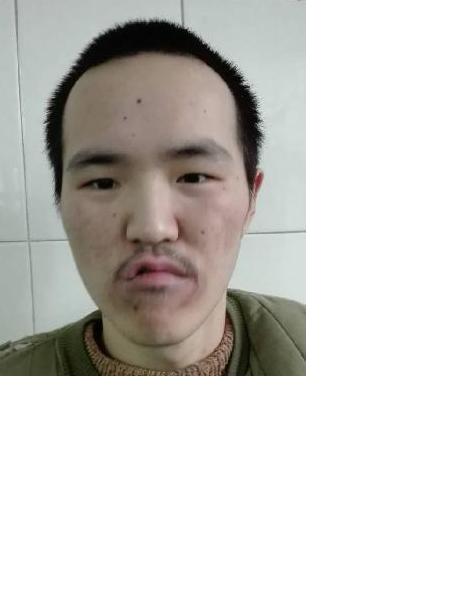 流浪人员无名0154照片，让爱回家