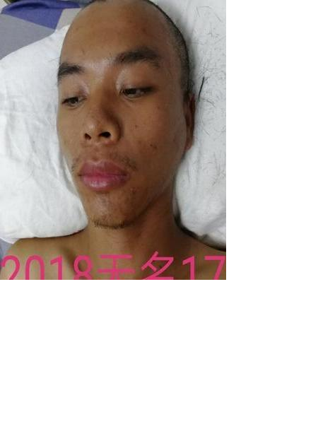 流浪人员2018无名17照片，让爱回家