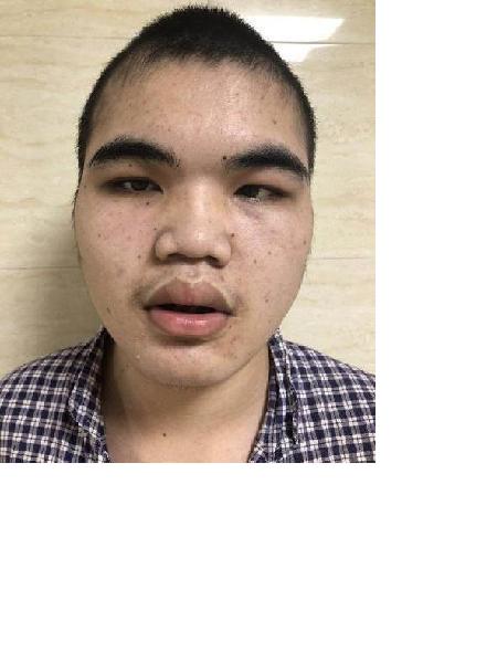流浪人员阳救军照片，让爱回家