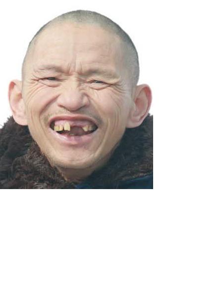 流浪人员救富生（医）照片，让爱回家