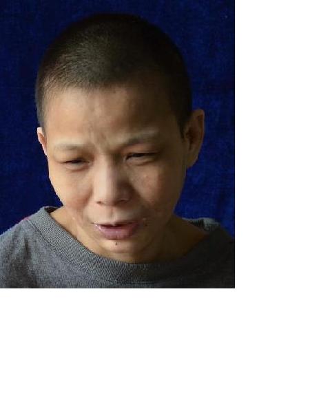 流浪人员衡救A100照片，让爱回家