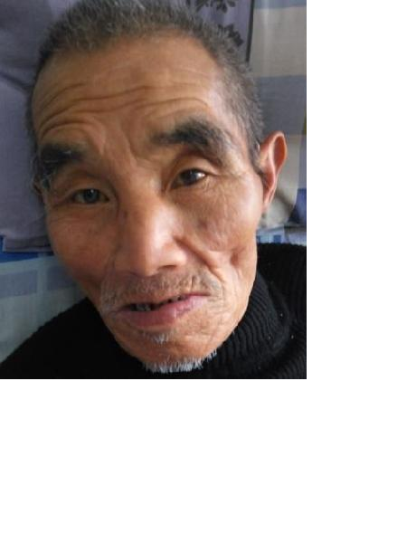 流浪人员王森哲照片，让爱回家