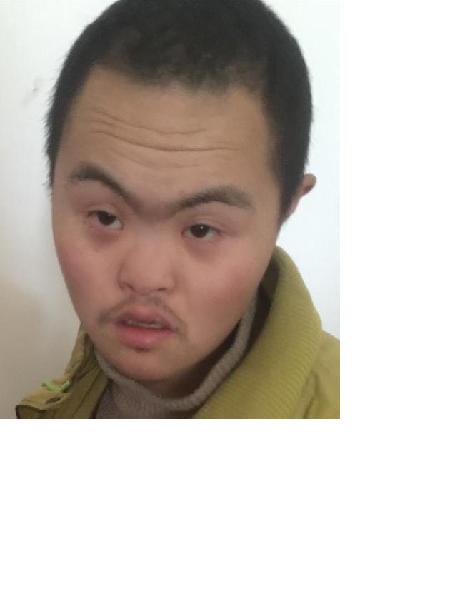 流浪人员无名男照片，让爱回家