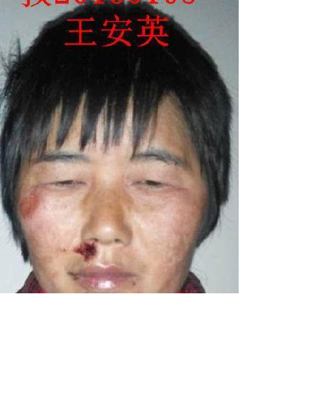 流浪人员无名氏照片，让爱回家