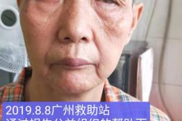 第1983个成功案例（广州市荔湾区长寿路李某珍回家）