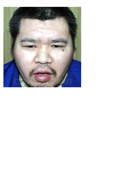 失踪人员王停震照片，让爱回家