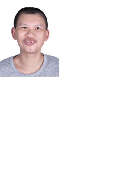 失踪人员王双照片，让爱回家