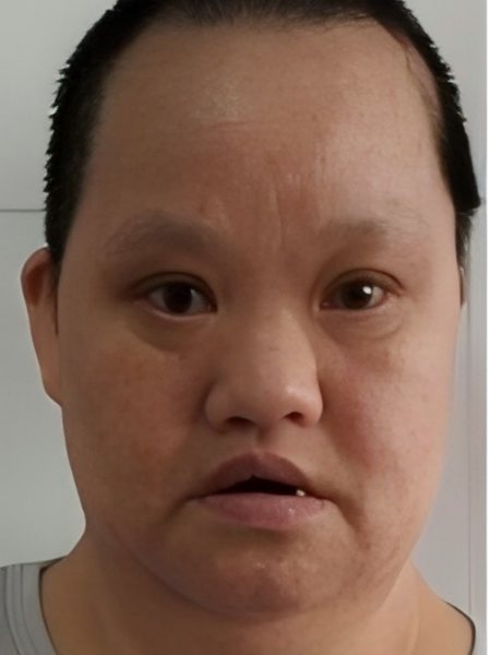 失踪人员丁棠红照片，让爱回家