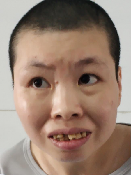 失踪人员于青芳照片，让爱回家