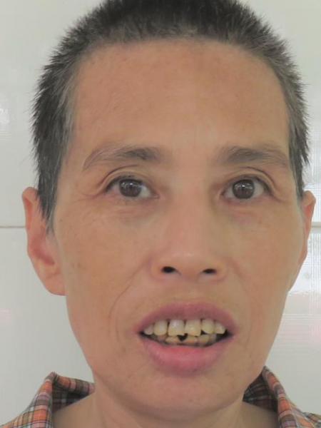 失踪人员尤明萍照片，让爱回家